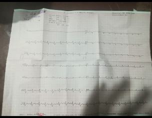 ECG Report