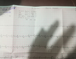 ECG Report