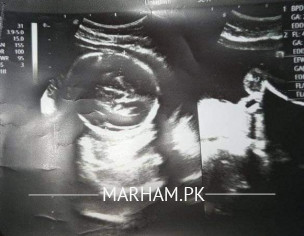 Sonologist Check My Report