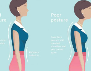 Posture Correction