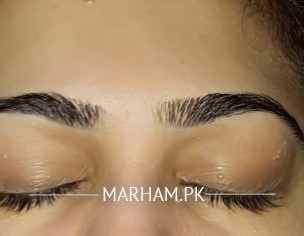 Query For Dermatologist