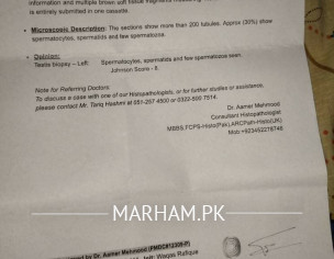 Semen Ejaculation Issue