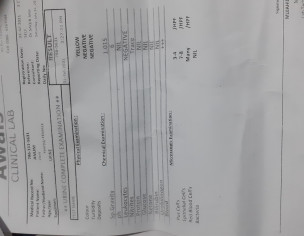 Lose Motion After Typhidot