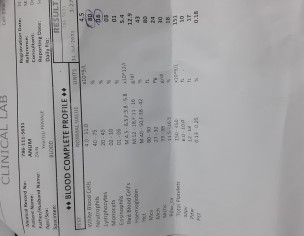 Lose Motion After Typhidot