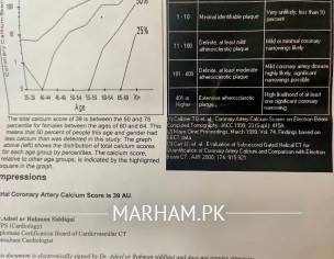 Coronary Artery Calcium Scan