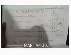 Check Report Ecg