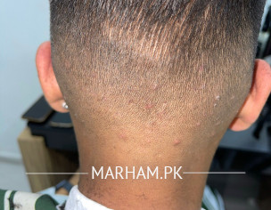 Have Been Observing These Since 3-4 Months