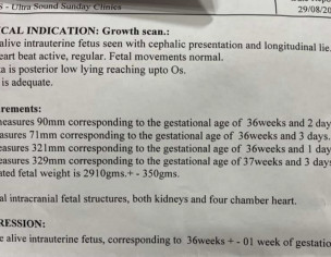 VBAC Associated Risk