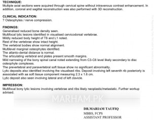 Back Pain Since 1 Month