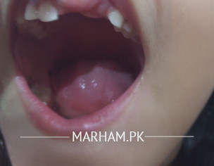 Dentist  Teeth Problem