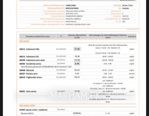 High Creatinine Serum 