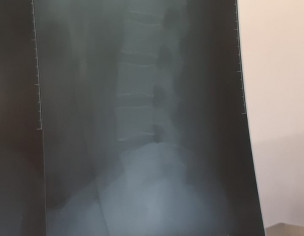 Back Pain Pathu Ka Drd