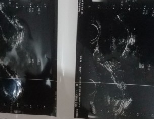 Need Answer From Gynea 