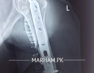 Feeling Severe Pain. 