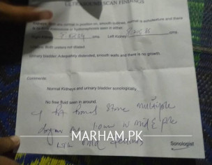 میرے گرد ے میں پھتری ہیں ڈاکٹر مجھے آپریشن کیلئے کہہ رہے