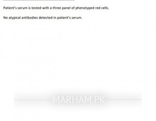 Explain Indirect Coombs Report