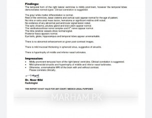 Depression, Weakness, Dizziness