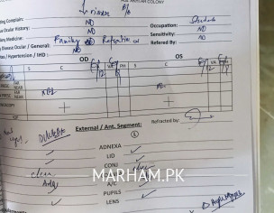 Continuous Decrease In Eye Sight