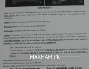 Kidney Stone Problem