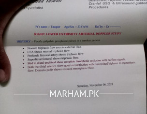 Popliteal Artery Thrombosis