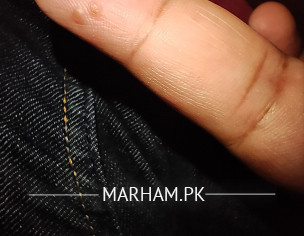 Warts On Finger Tips