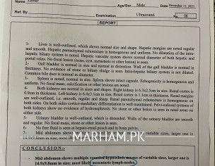 Mesenteric Lymphadenitis And Cholelithiasis 