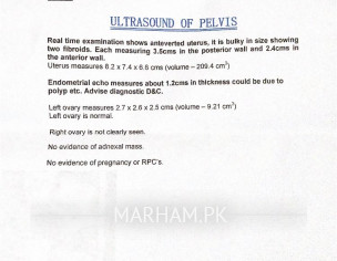 Uterus Cyst