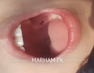Problem In Mouth