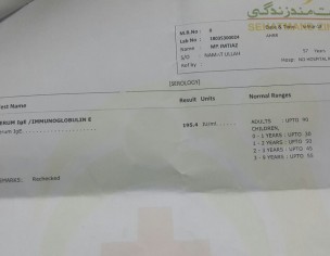 Reports, Advice Plz!