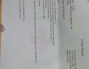 Reports, Advice Plz!