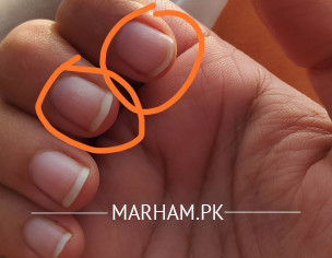 Small Circles On Nails