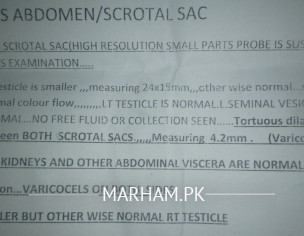 Abnormal Testes Size