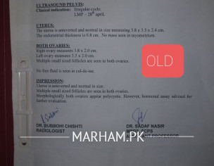 PCOS, Prolong Bleeding UNMARRIED