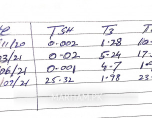 Hyper To Hypothyroid