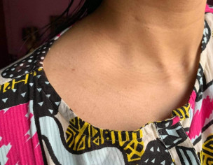 Texture / Dark Lines On Neck