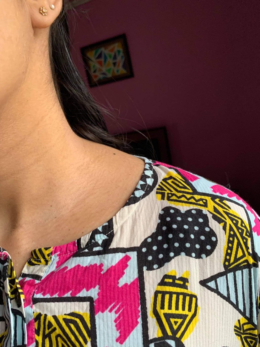 Ask a Dermatologist Online for Texture / Dark Lines On Neck