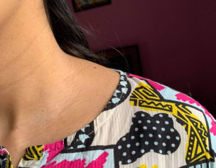 Texture / Dark Lines On Neck