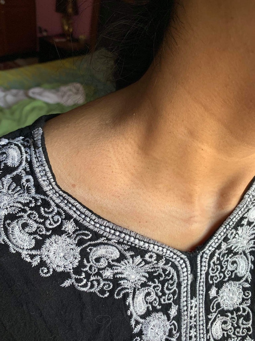 Ask a Dermatologist Online for Texture / Dark Lines On Neck