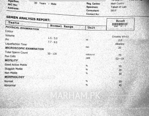 Seman Analysis Report Timing Issues