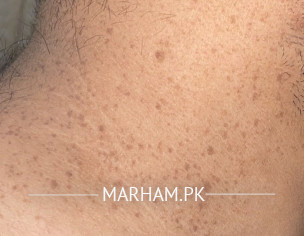 I Have Skin Problems 