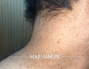 I Have Skin Problems 