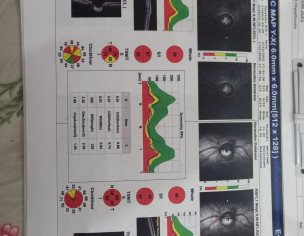Eye Pressure To Check