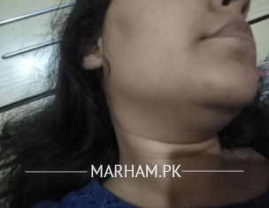 Hyperpigmentation And Dark Spots