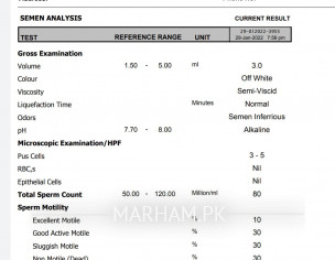 Please Cheak My  Report