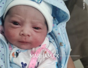 4th Month  Baby Eye Problem