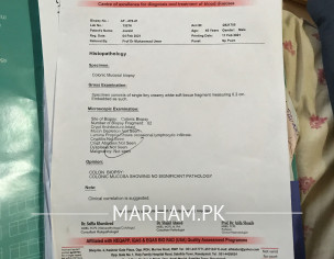 Pain After External Hemorroids Banding Surgery 