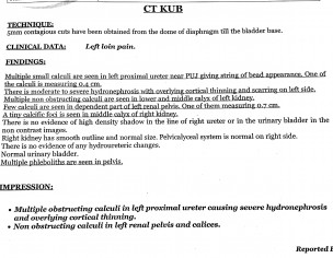 Kindney  Poor Function