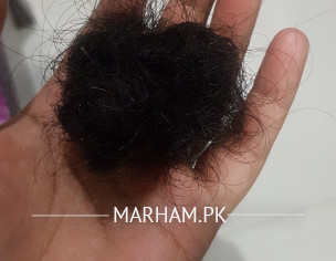 Postpartum Hair Loss