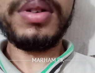 Information About Braces