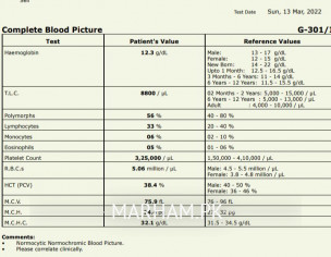 Please Check Reports